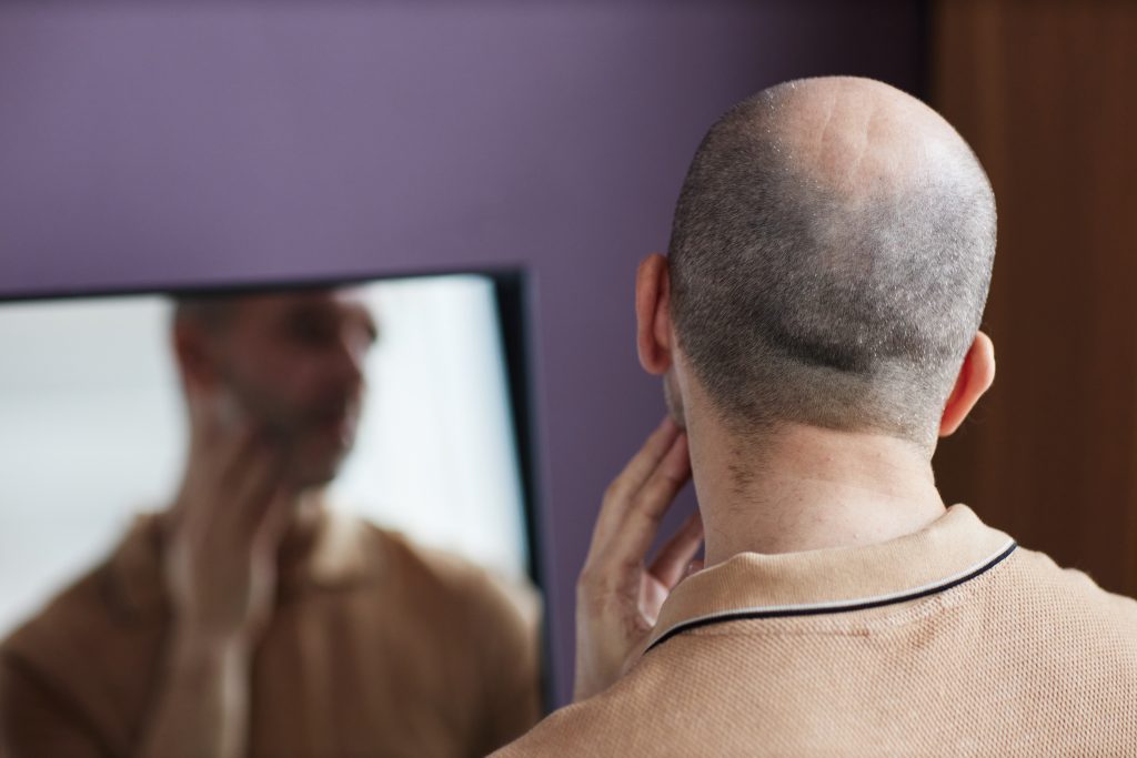 back view of insecure bald man looking in mirror 2026 03 20 03 15 00 utc